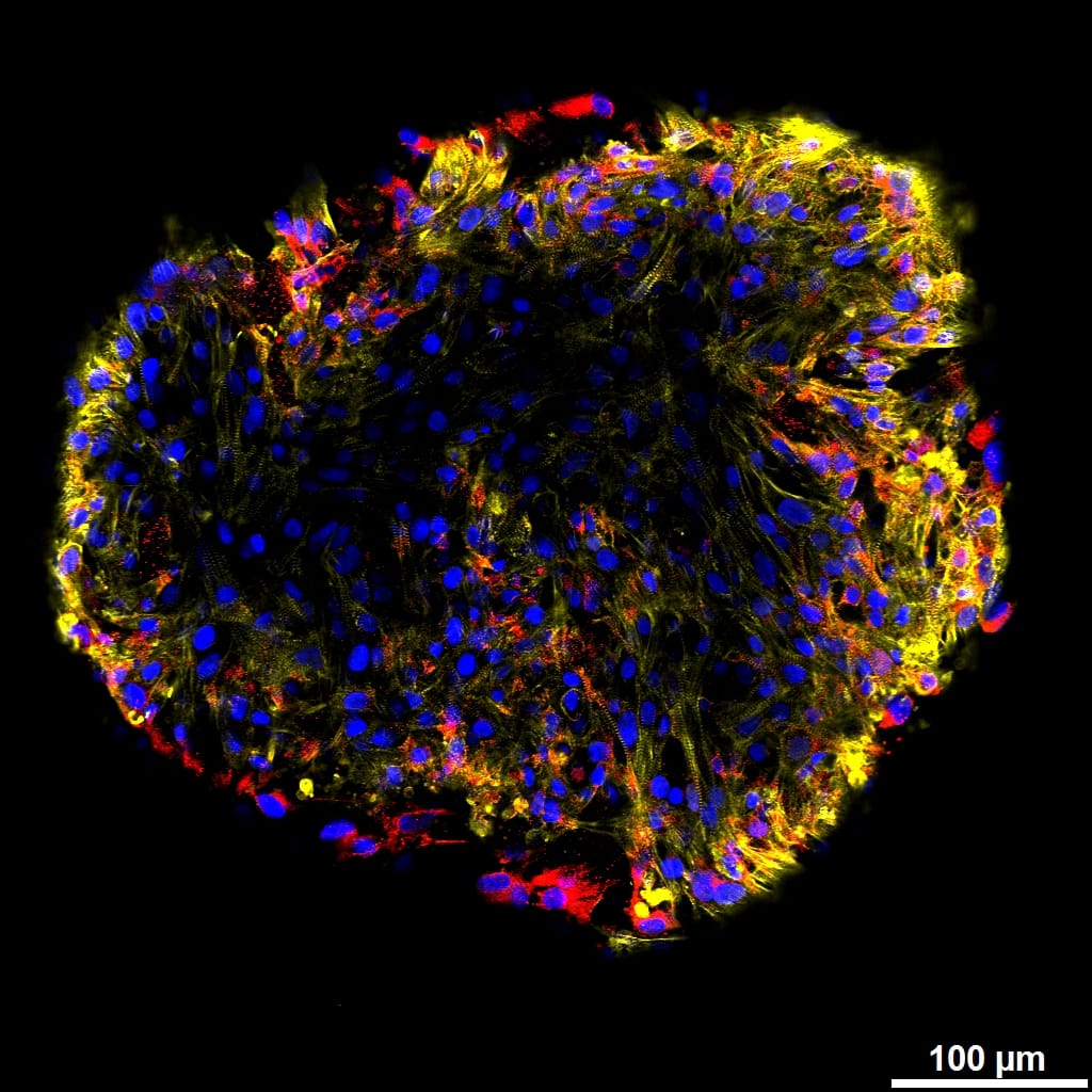 2026 overlay — Cx43 + α-Actinin + nuclei